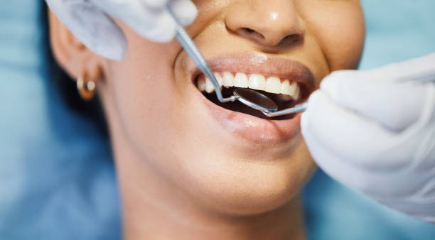 Best Emergency Denture Repair in Coral Springs, FL
